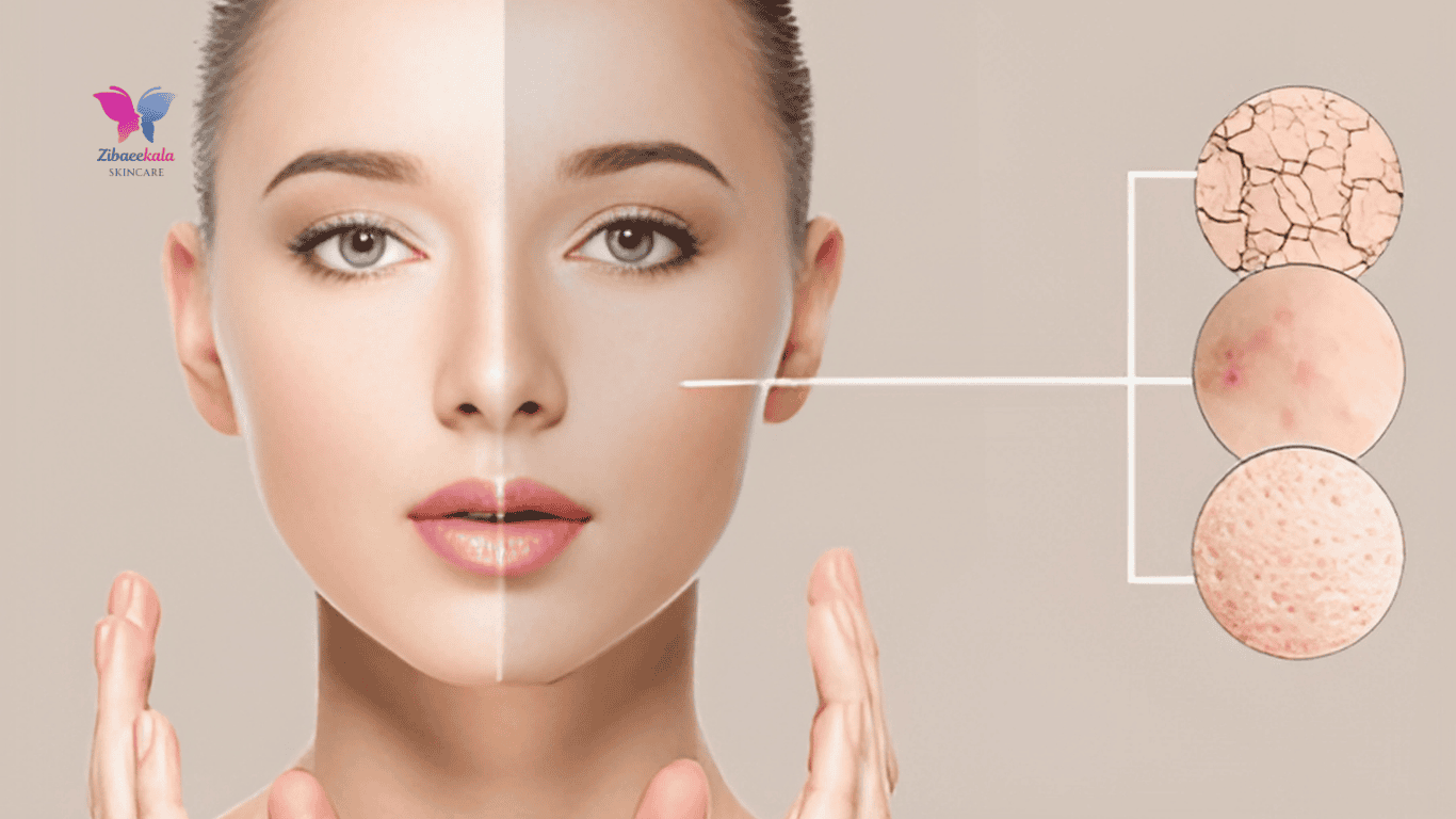 چیکار کنم پوستم جوش نزنه؟