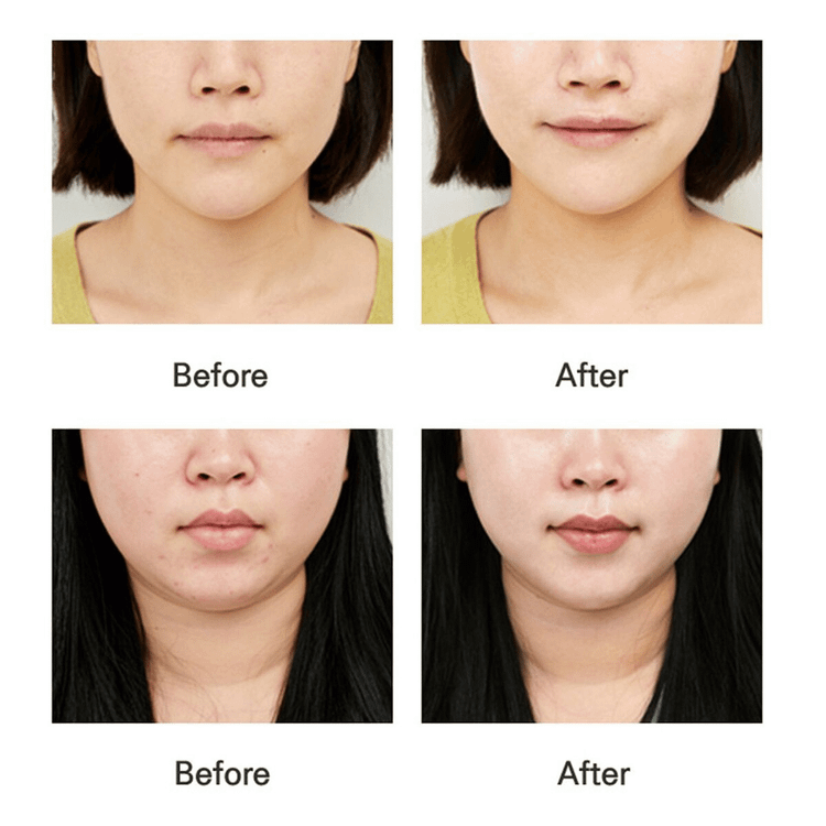 سرم ولی ولی لکه های تیره