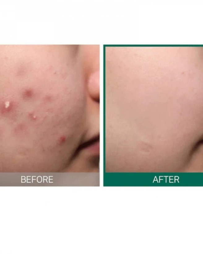 کرم ضد لک و جوانساز سام بای می مدل میراکل