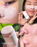ماسک گل رس استیکی ضد جوش و کنترل چربی پوست با عصاره سنتلا آسیاتیکا محصول کرهای اصل