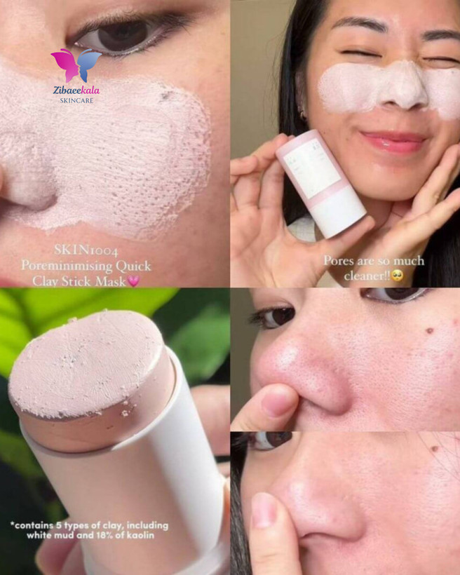 ماسک گل رس استیکی ضد جوش و کنترل چربی پوست با عصاره سنتلا آسیاتیکا محصول کرهای اصل