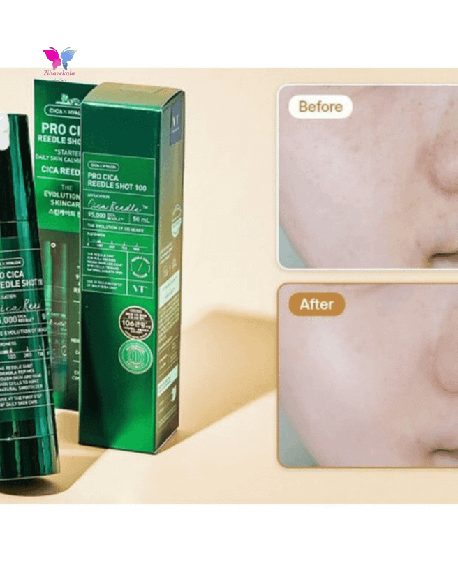کیج ۱۰ عددی ساشه سرم VT Reedle Shot 100 Pro Cica، درمان میکرونیدلینگ خانگی ملایم برای پوستهای حساس و مستعد آکنه